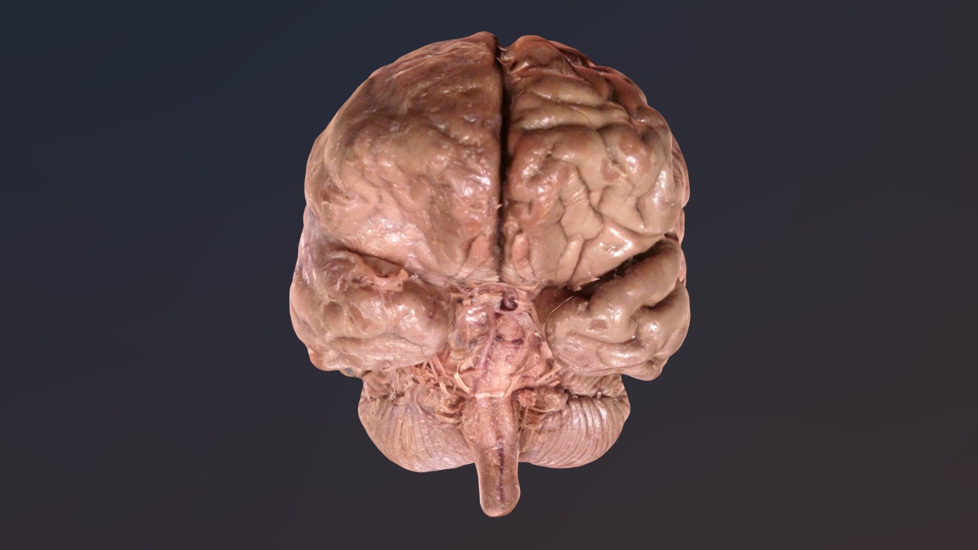 human brain, plastinated, one hlaf covered by arachnoid mater, other half subarachnoidal with cranial nerves visible
authors: A. Brunnmeier, D. Studer, B. Hensen, G. Toubekis, R. Klamma Computer Sciences 5, RWTH Aachen, Germany; S.L. Behrens, Neuroanatomy, UK Aachen, Germany; A. Herrler, Anatomy &amp; Embryology, FHML, Maastricht University, The Netherlands 
Creative Commons Attritbution – Non Commercial – Share Alike - Brain - 3D model by aherrler 3d model
