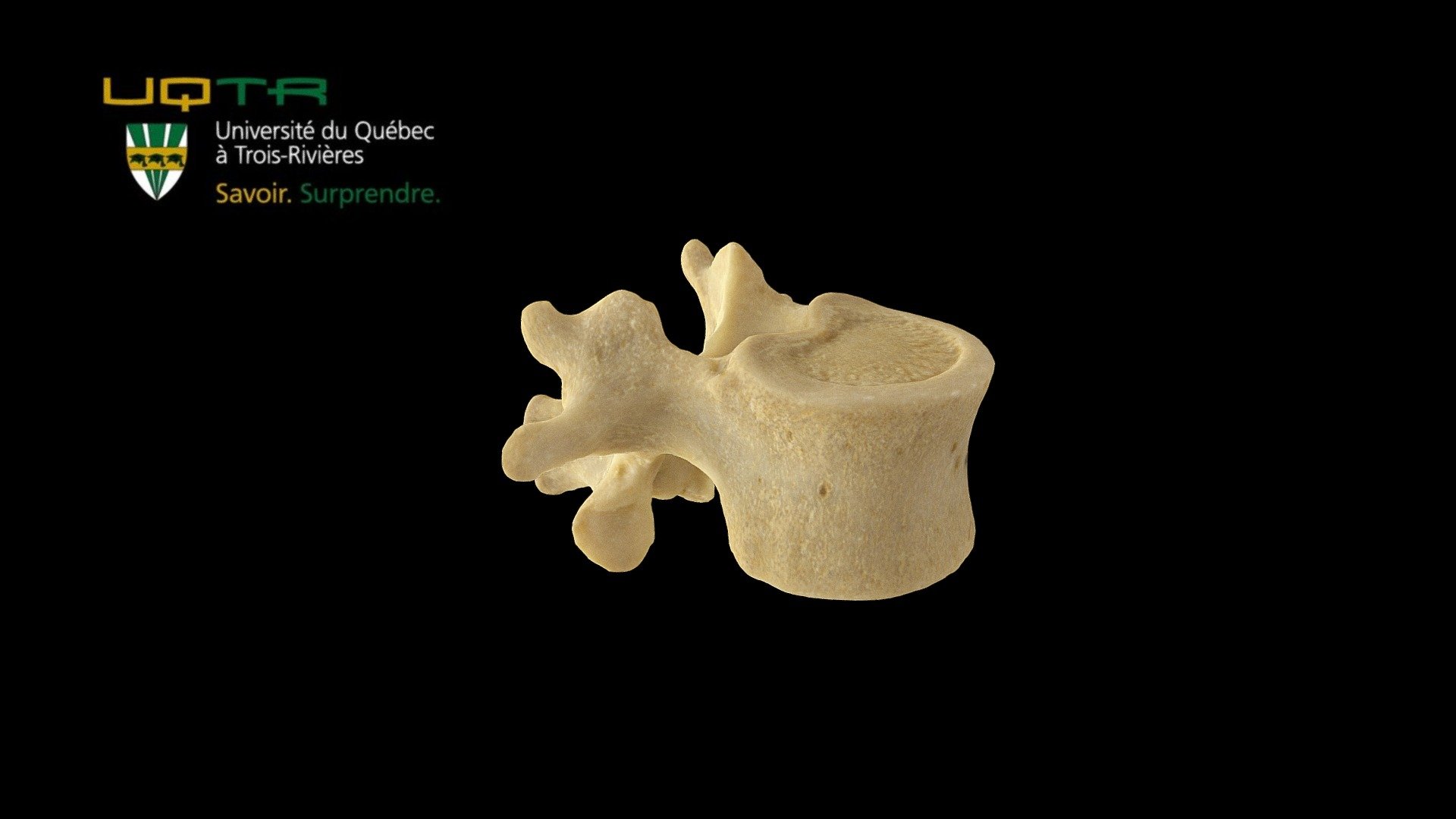 Vertèbre lombale / Lumbar vertebra - 3D model by Anatomie UQTR - Anatomy UQTR (@AnatomieUQTR) 3d model