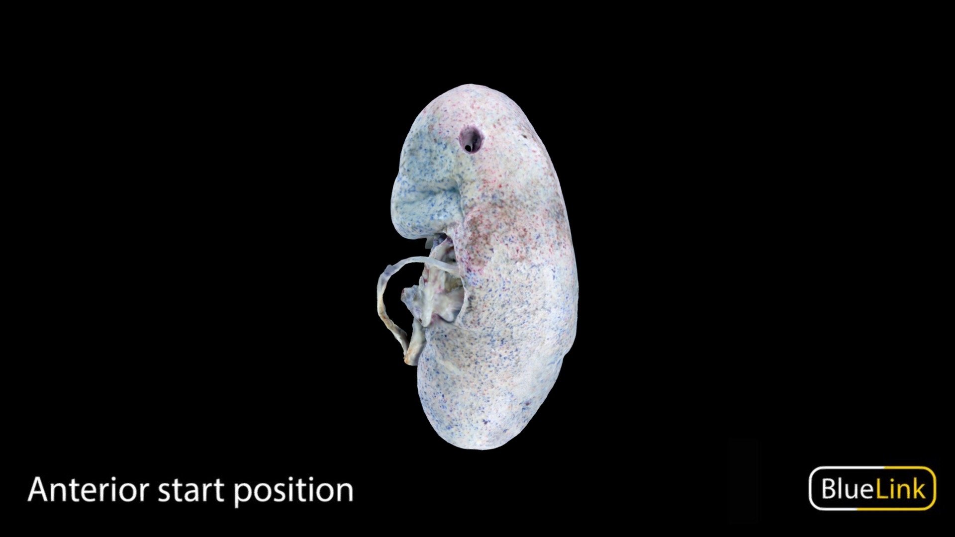Bisected left kidney with colored vasculature

Captured using photogrammetry

Captured and edited by Nikita Shishu and Julia Egnaczyk

Copyright 2022 BK Alsup &amp; GM Fox

31550 - A02 - Bisected Colored Kidney - Left - 3D model by Bluelink Anatomy - University of Michigan (@bluelinkanatomy) 3d model