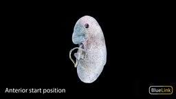 Bisected Colored Kidney