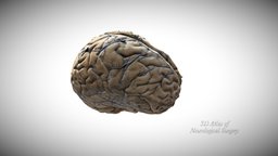 2- Brain without arachnoid anatomy, brain, cranial, nerves, neurosurgery