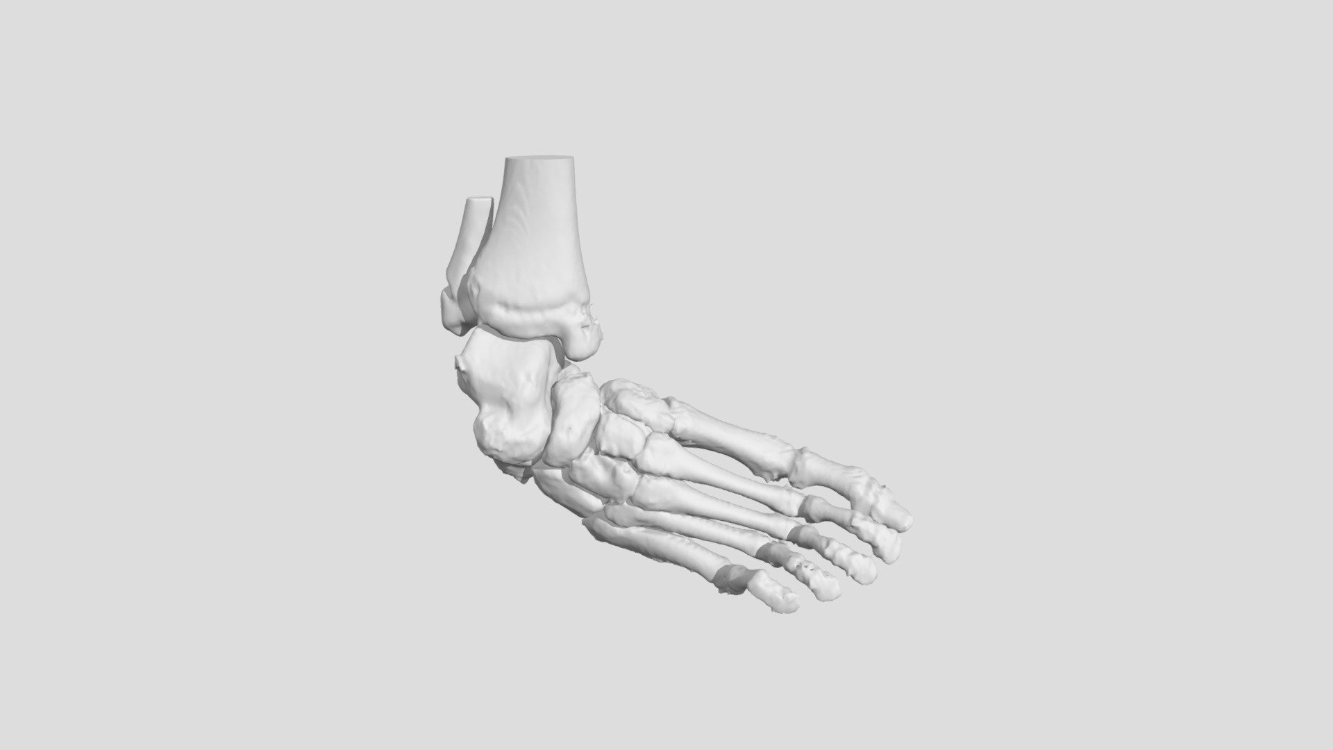 S0286 - Foot Deformity (S0286) - 3D model by NCH Advanced Projects Laboratory (APL) 3d model