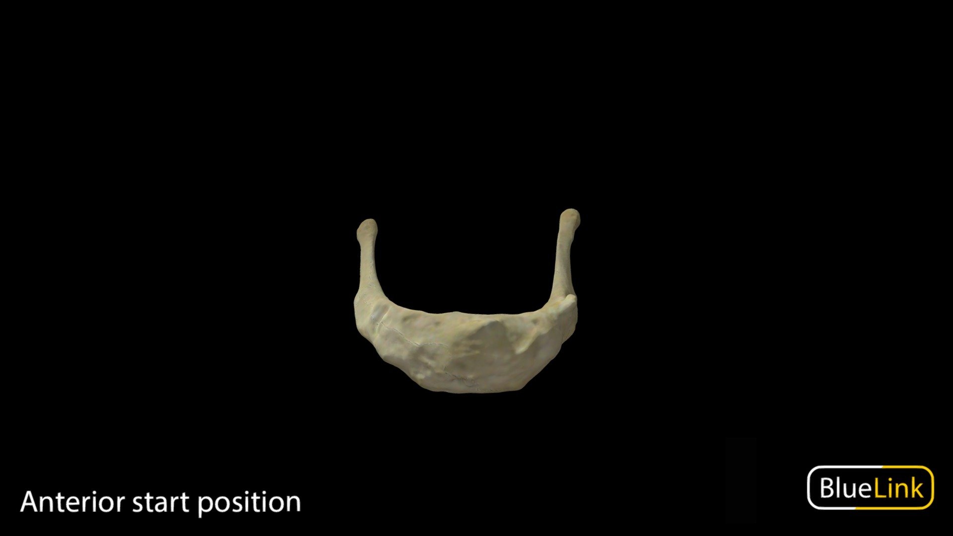 3D scan of the Hyoid

Captured with Einscan Pro

Captured and edited by: Will Gribbin

Copyright2019 BK Alsup &amp; GM Fox - Hyoid - 3D model by Bluelink Anatomy - University of Michigan (@bluelinkanatomy) 3d model