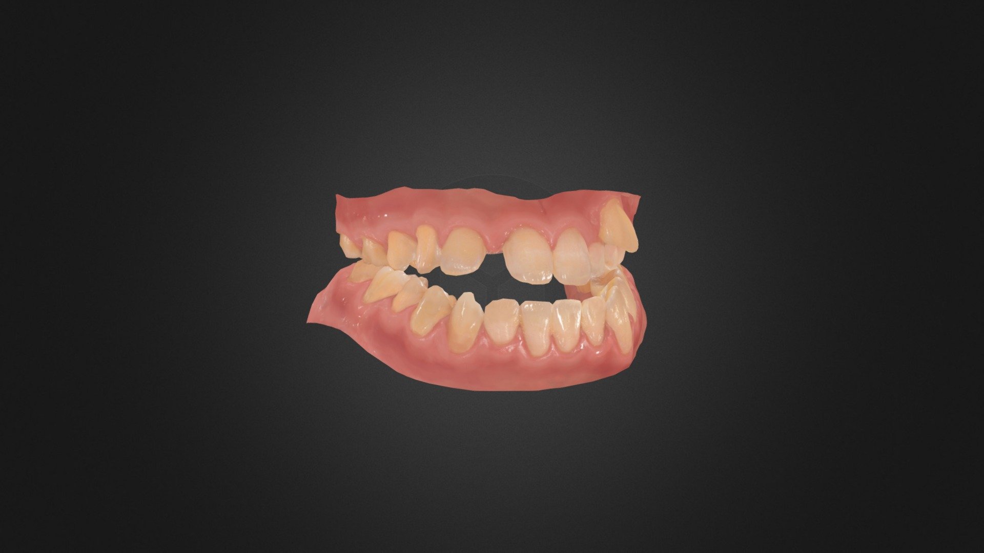 Teeth - 3D model by Jo (@xk2000xk) 3d model