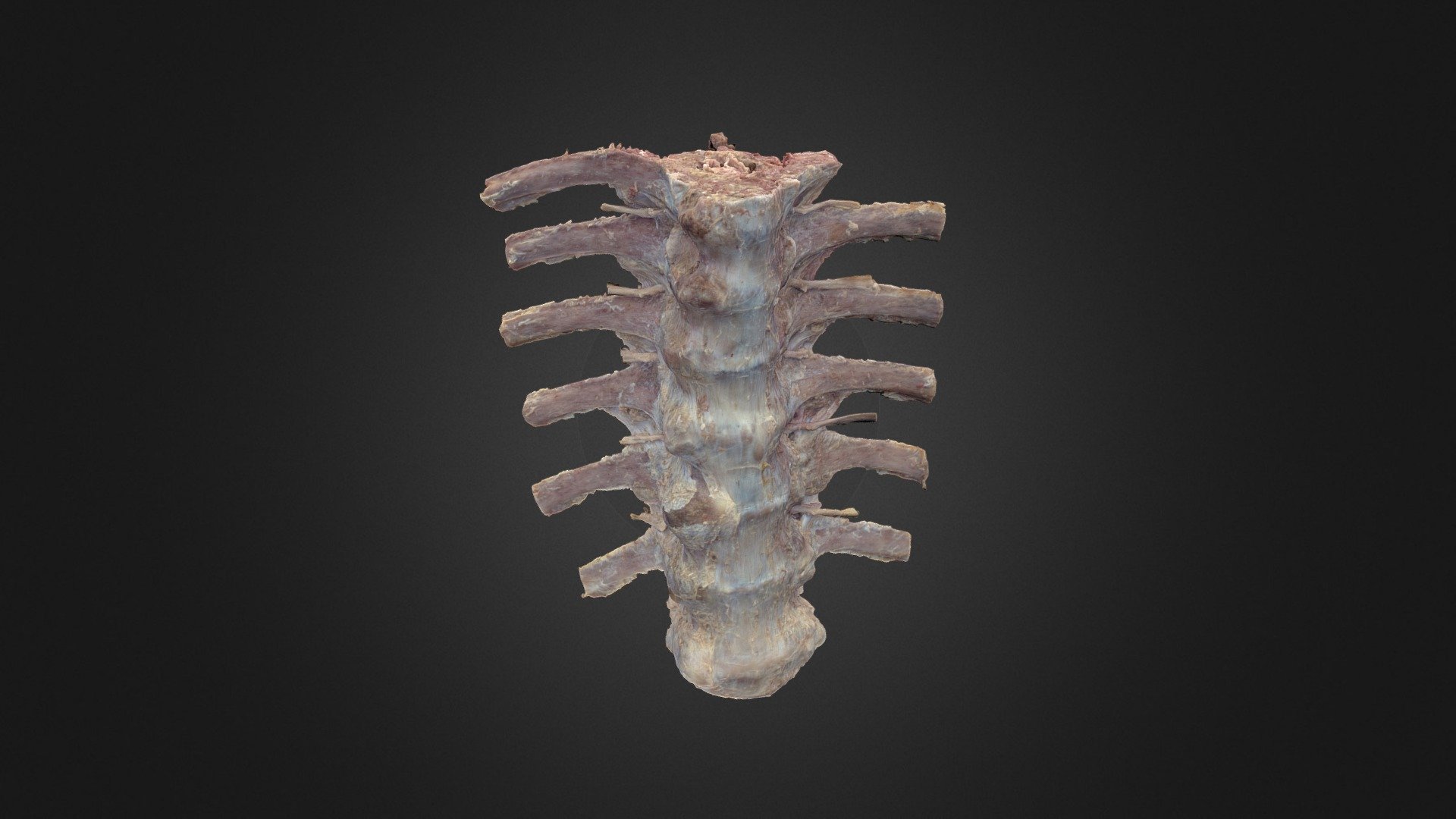 A human prosection showing lower thoracic vertebrae, ribs, and intercostal nerves. 

For more on the thorax, visit: https://clinicalanatomy.ca/thorax/Thorax/story.html

Produced by the HIVE at the University of British Columbia using Reality Capture and Artec Studio. 
 

Credits: 

Dr. Claudia Krebs (Faculty Lead) 

Ishan Dixit 

Connor Dunne 

Monika Fejtek - Thoracic Vertebrae with Ribs - 3D model by UBC Medicine - Educational Media 3d model