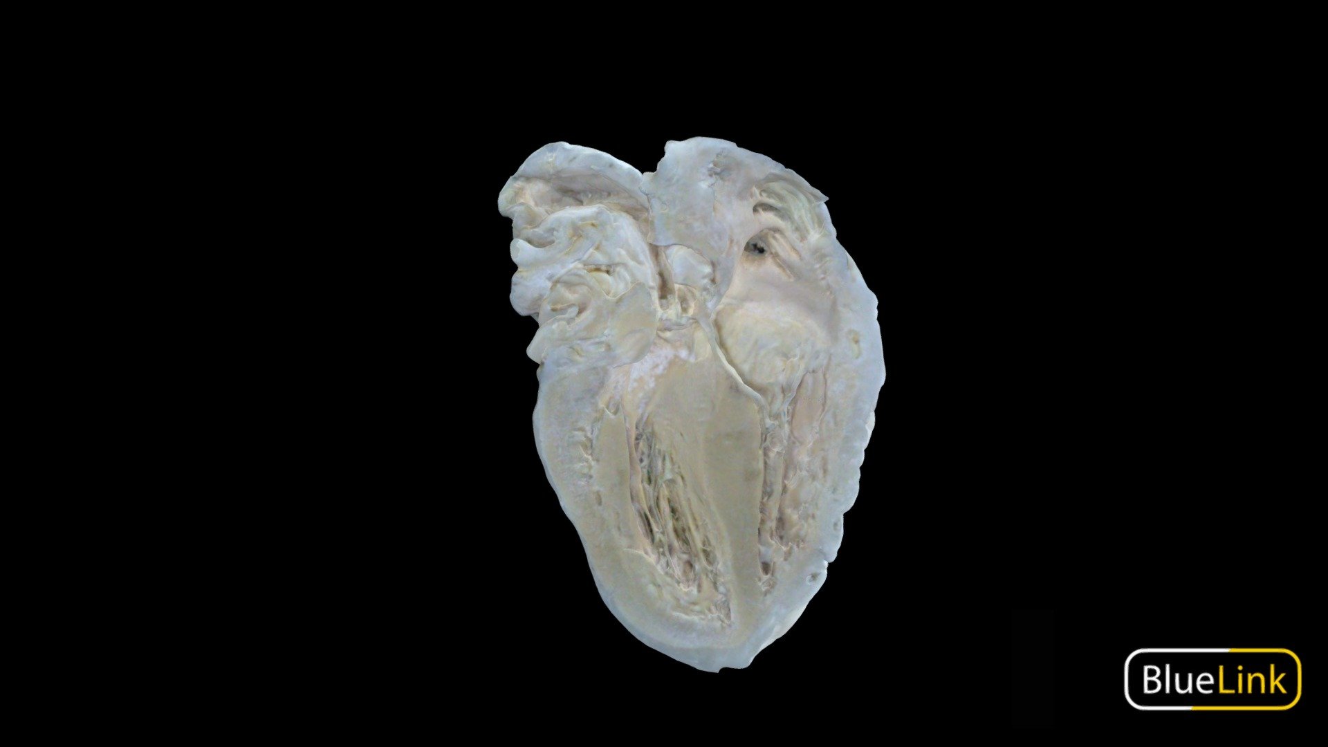 Hemisection of Human Heart 
Captured with: Einscan Pro
Captured by: Will Gribbin
Edited by: Cristina Prall
University of Michigan
91008-C01 - Atria & Ventricles - Hemisection 1 - 3D model by Bluelink Anatomy - University of Michigan (@bluelinkanatomy) 3d model
