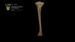 Tibia gauche / Left tibial bone 