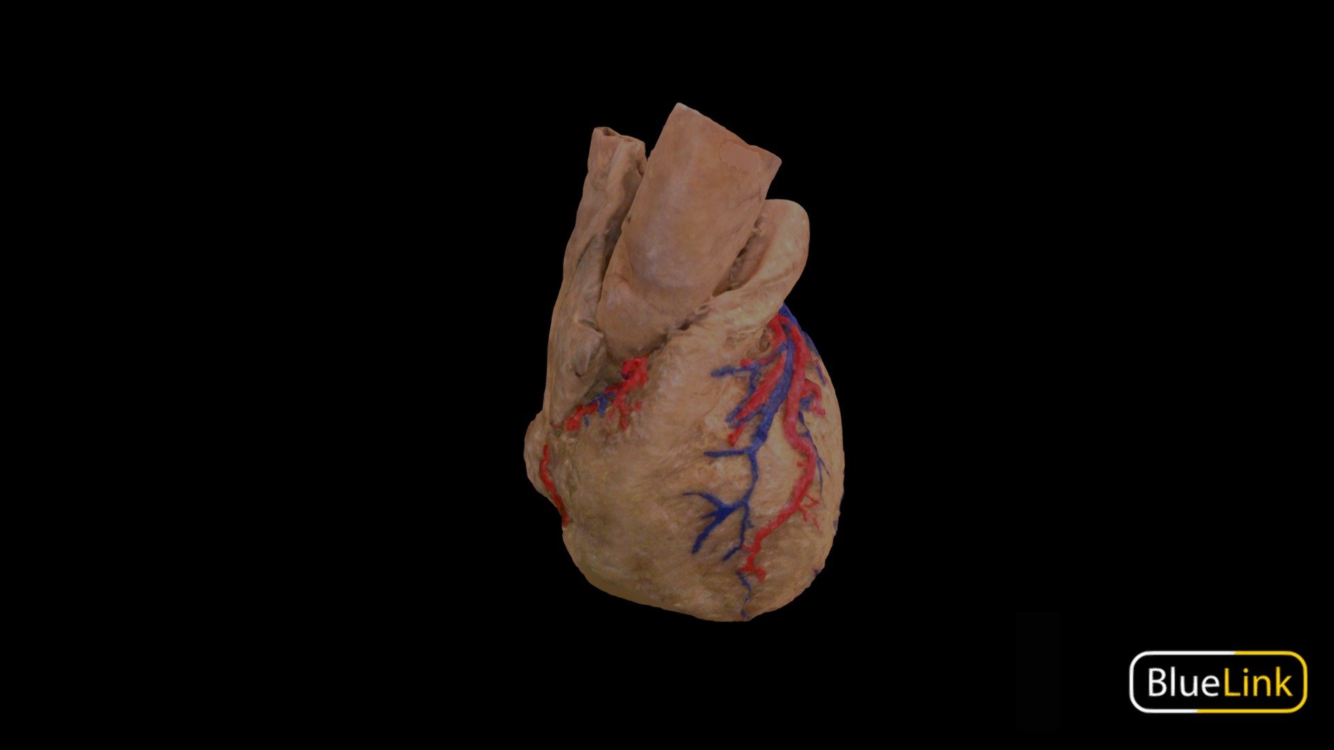 3D scan depicting the vascular supply of the human heart
Captured with: Einscan Pro
Captured by: Will Gribbin
Edited by: Cristina Prall
University of Michigan
21905-C01 - External Heart Vasculature - Labeled - 3D model by Bluelink Anatomy - University of Michigan (@bluelinkanatomy) 3d model