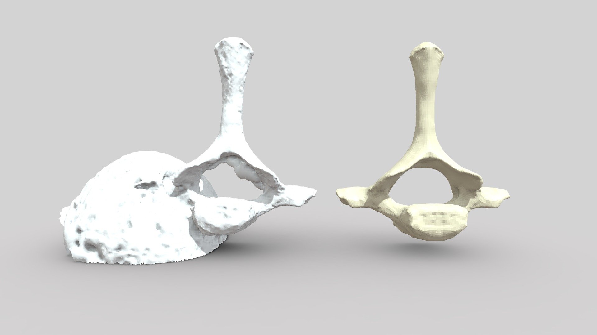 Here the T2, the second thoracic vertebra of Rattus norvegicus. I'm getting better at the photogrammetry scans! The raw model compared to a high poly remesh 3d model