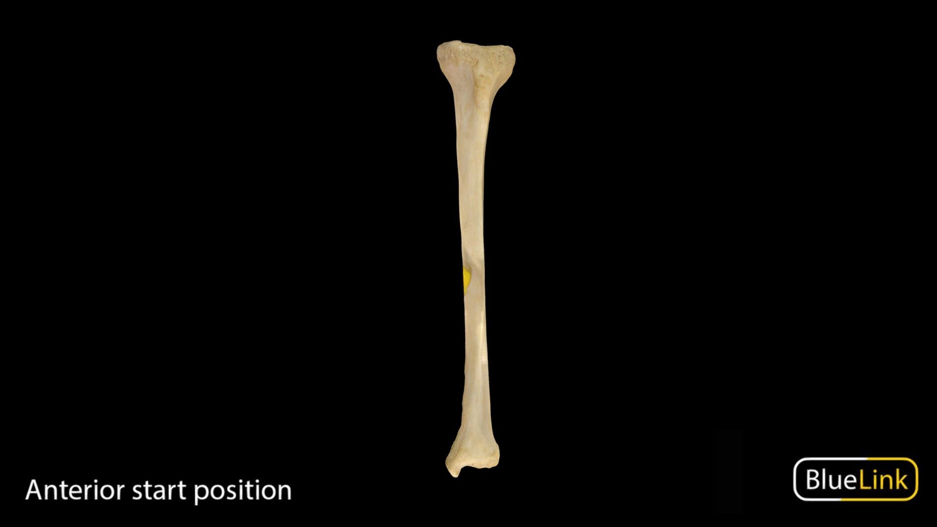 Human tibia

Captured with: EinScan Pro

Captured and edited by: Cristina Prall

University of Michigan - Tibia - 3D model by Bluelink Anatomy - University of Michigan (@bluelinkanatomy) 3d model