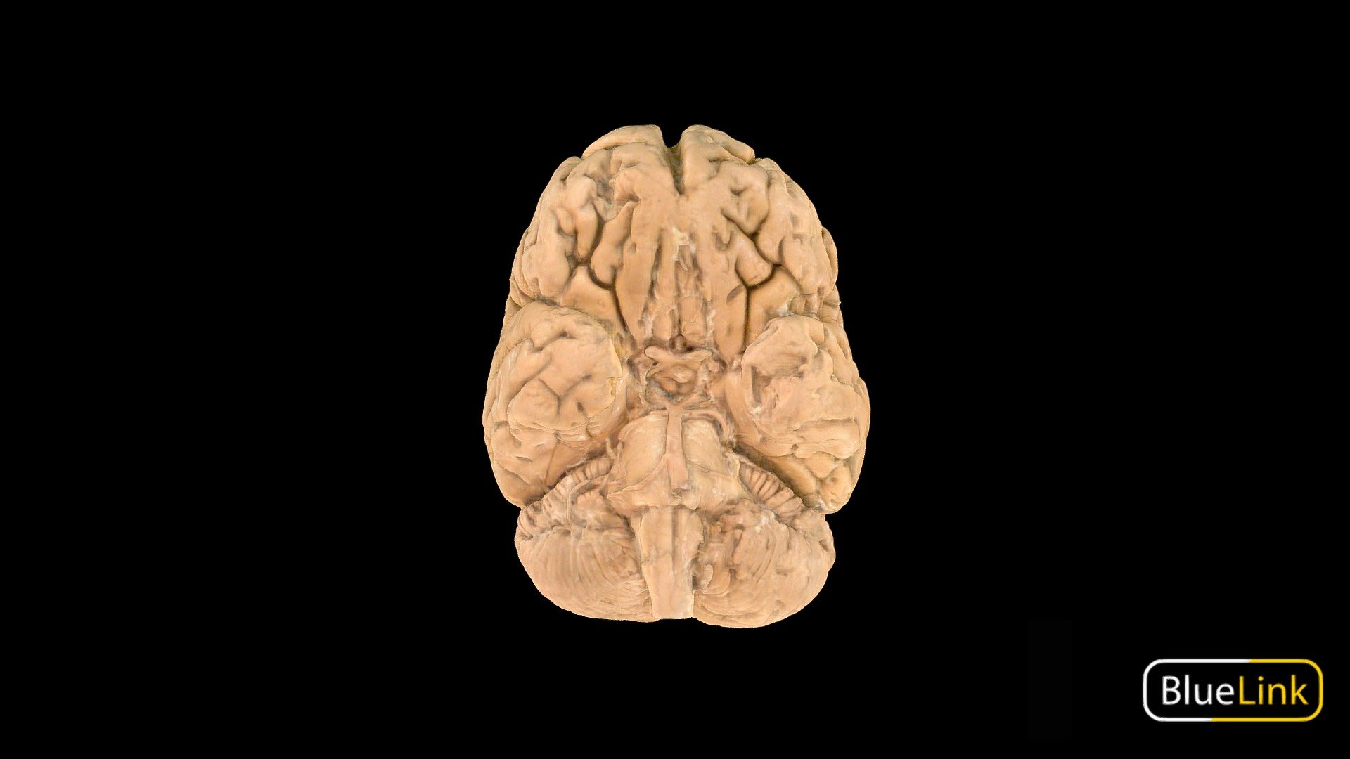 3D scan of the brain with section cut out to display the hippocampus

Captured with Einscan Pro

Captured and edited by: Madelyn Murphy, Cristina Prall

Copyright2019 BK Alsup &amp; GM Fox - Brain - Inferior Surface CN & Arteries, Labeled - 3D model by Bluelink Anatomy - University of Michigan (@bluelinkanatomy) 3d model