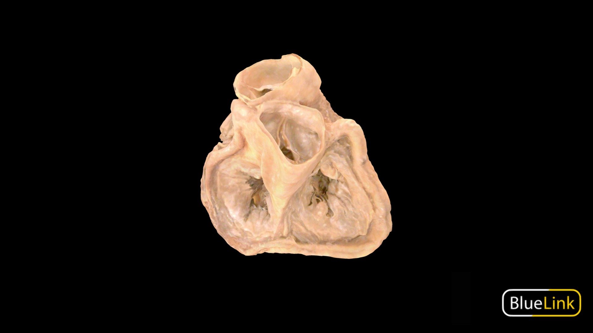 Human heart with atria removed to show heart valves
Captured with: Einscan Pro
Captured by: Will Gribbin
Edited by: Cristina Prall
University of Michigan
25981-C01 - Heart Valves - 3D model by Bluelink Anatomy - University of Michigan (@bluelinkanatomy) 3d model