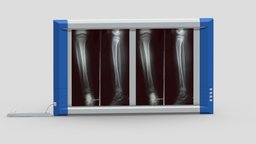 Medical X-Ray Light Box