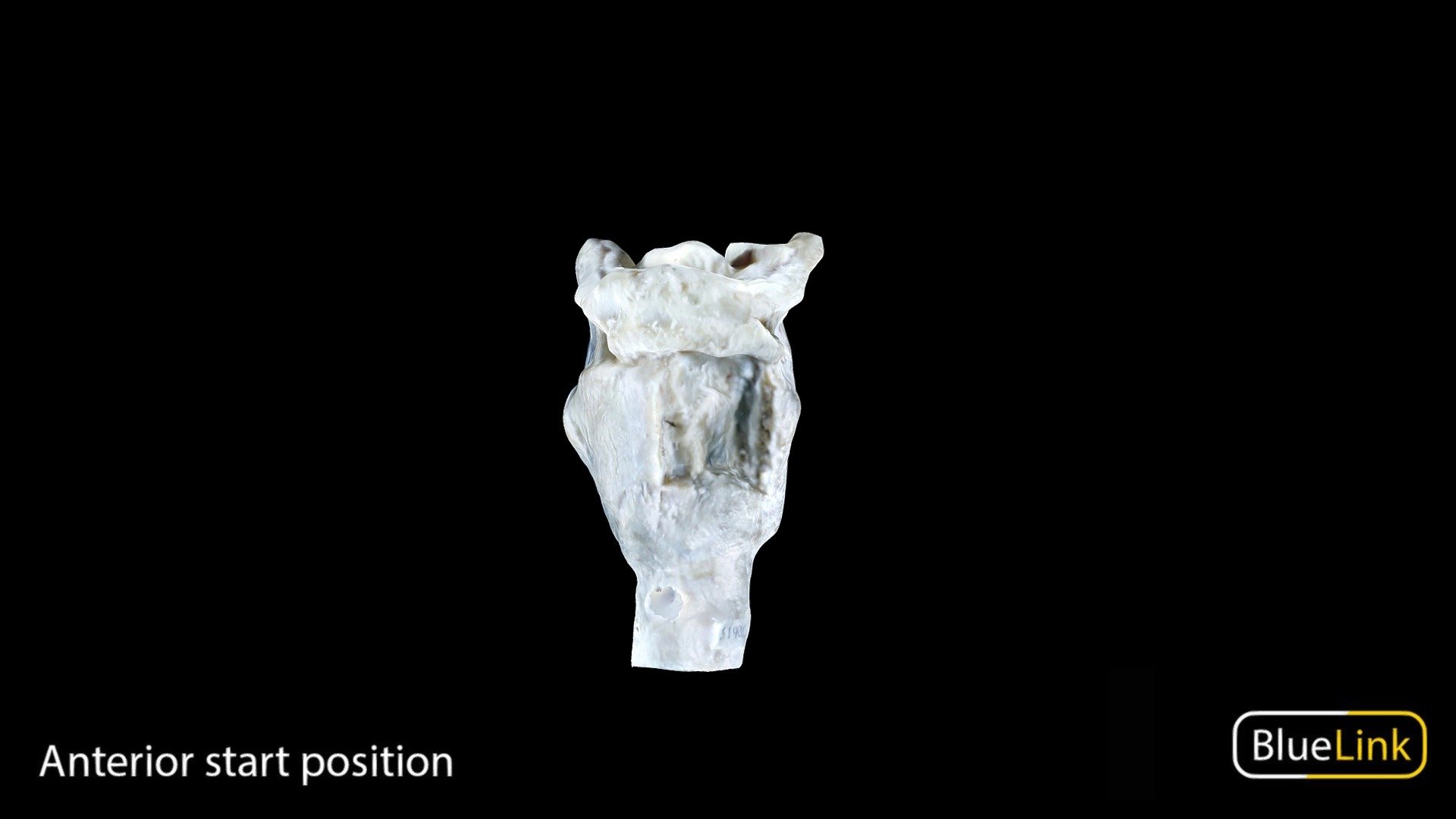 Model of a whole larynx

Captured with photogrammetry

Captured and edited by: Nikita Shishu

Copyright 2023 BK Alsup &amp; GM Fox

31906-H07 - Larynx - 3D model by Bluelink Anatomy - University of Michigan (@bluelinkanatomy) 3d model